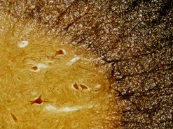 Dauerpräparate: Histologie><noscript><img width=